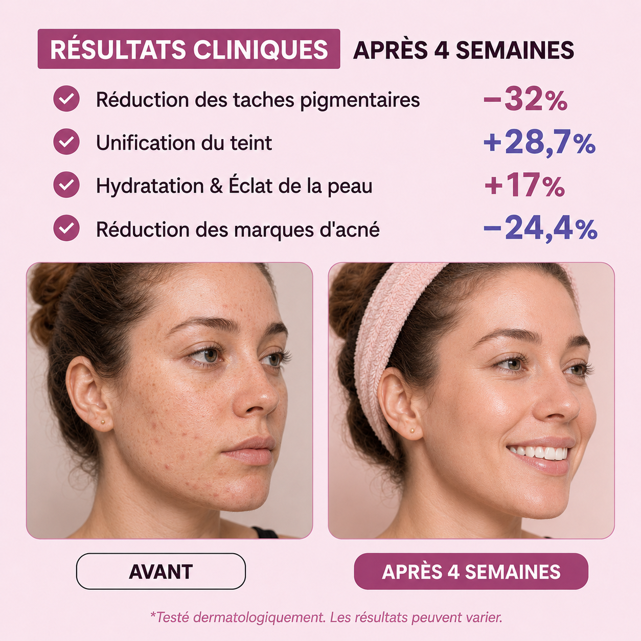 GLOWSKIN Bar — Anti-Taches & Hyperpigmentation