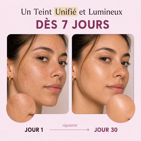 GLOWSKIN Ritual — La Gamme complète Anti-Taches & Hyperpigmentation